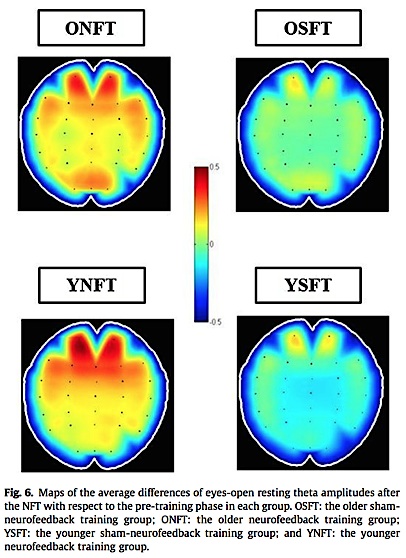 Wang & Hsieh fig.6 Brain Map changes